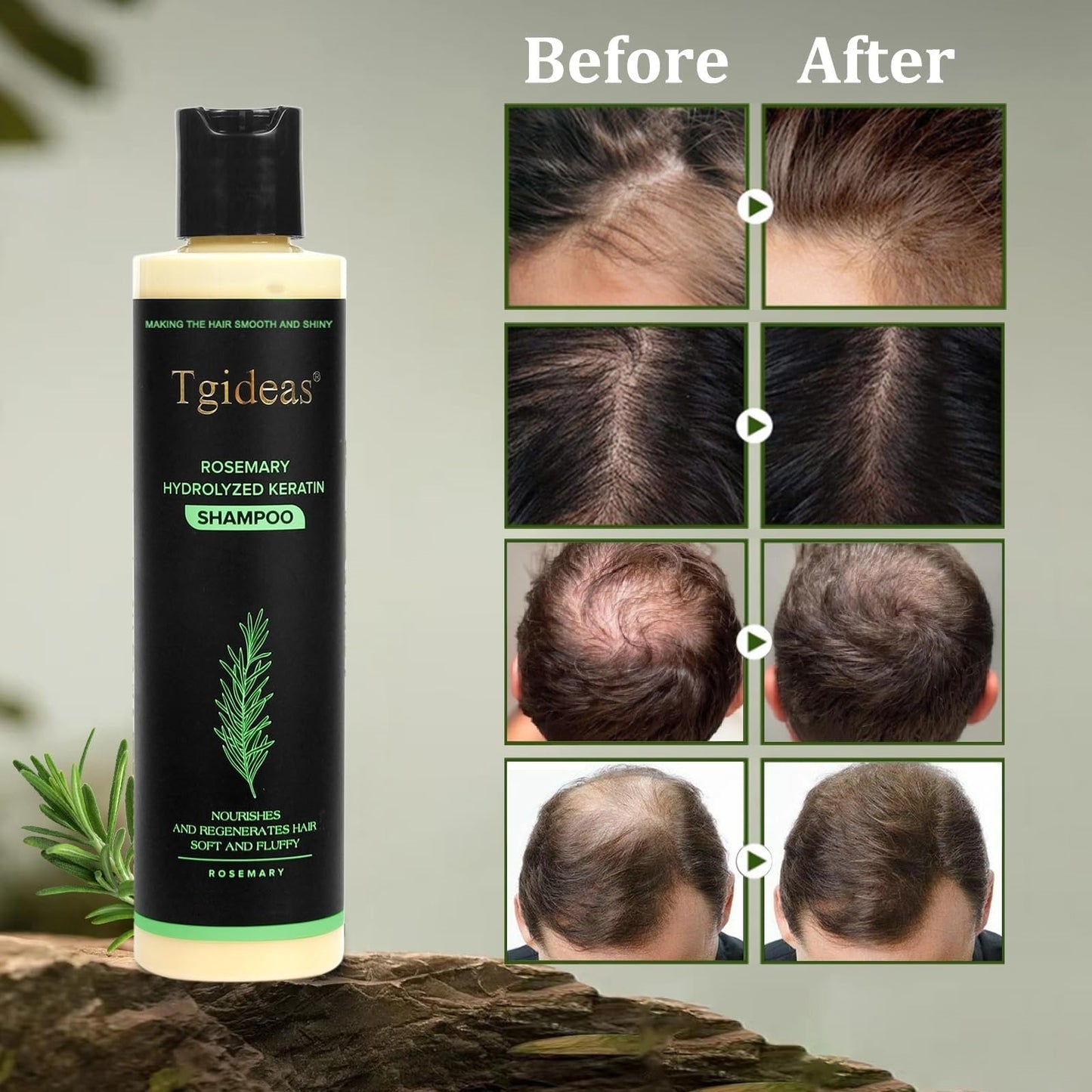 Tgideas Organic Rosemary Hair Growth Shampoo
